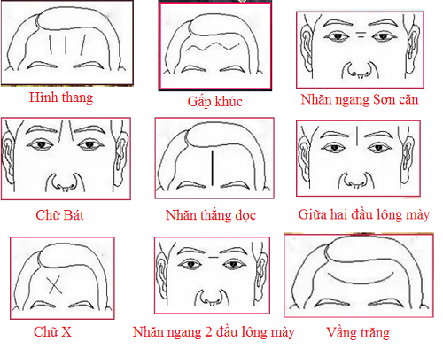 Biết đích xác vận mệnh giàu nghèo qua tướng nếp nhăn hình ảnh gốc Biet dich xac van menh giau ngheo qua tuong nep nhan hinh anh goc