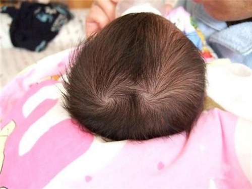 Cha mẹ xem xoáy tóc đỉnh đầu đoán định tương lai con trẻ hình ảnh Cha me xem xoay toc dinh dau doan dinh tuong lai con tre hinh anh