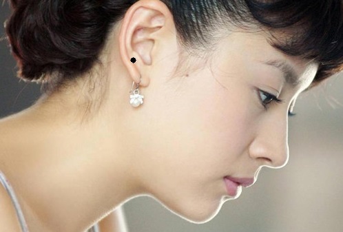Chỉ ra nốt ruồi phú quý trên mặt nữ giới trong 3 nốt nhạc hình ảnh Chi ra not ruoi phu quy tren mat nu gioi trong 3 not nhac hinh anh