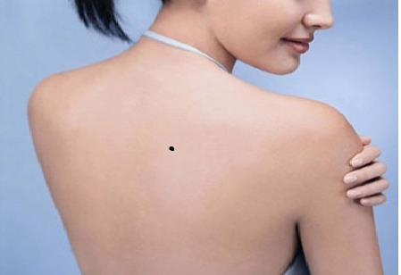 Có được nốt ruồi phú quý này, cả đời không phải lo phiền hình ảnh Co duoc not ruoi phu quy nay, ca doi khong phai lo phien hinh anh