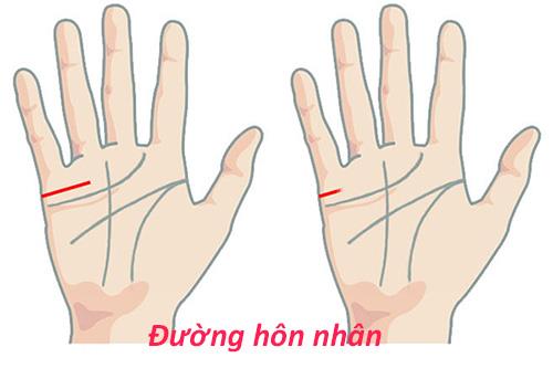 đường hôn nhân mờ nhạt hoặc không có duong hon nhan mo nhat hoac khong co