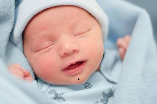 nốt ruồi ở cằm not ruoi o cam
