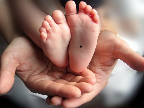 nốt ruồi ở lòng bàn chân trái not ruoi o long ban chan trai