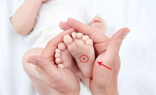 not ruoi o long ban chan nốt ruồi ở lòng bàn chân