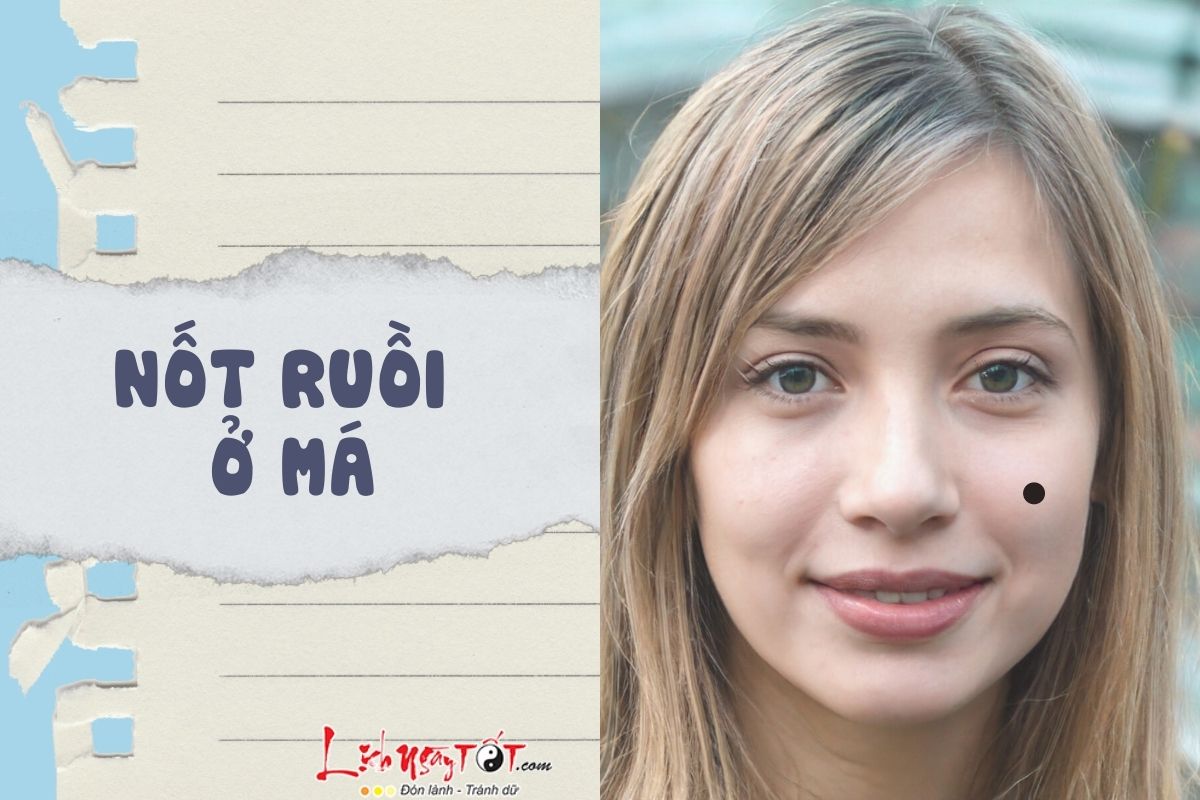 Nốt ruồi ở má Not ruoi o ma
