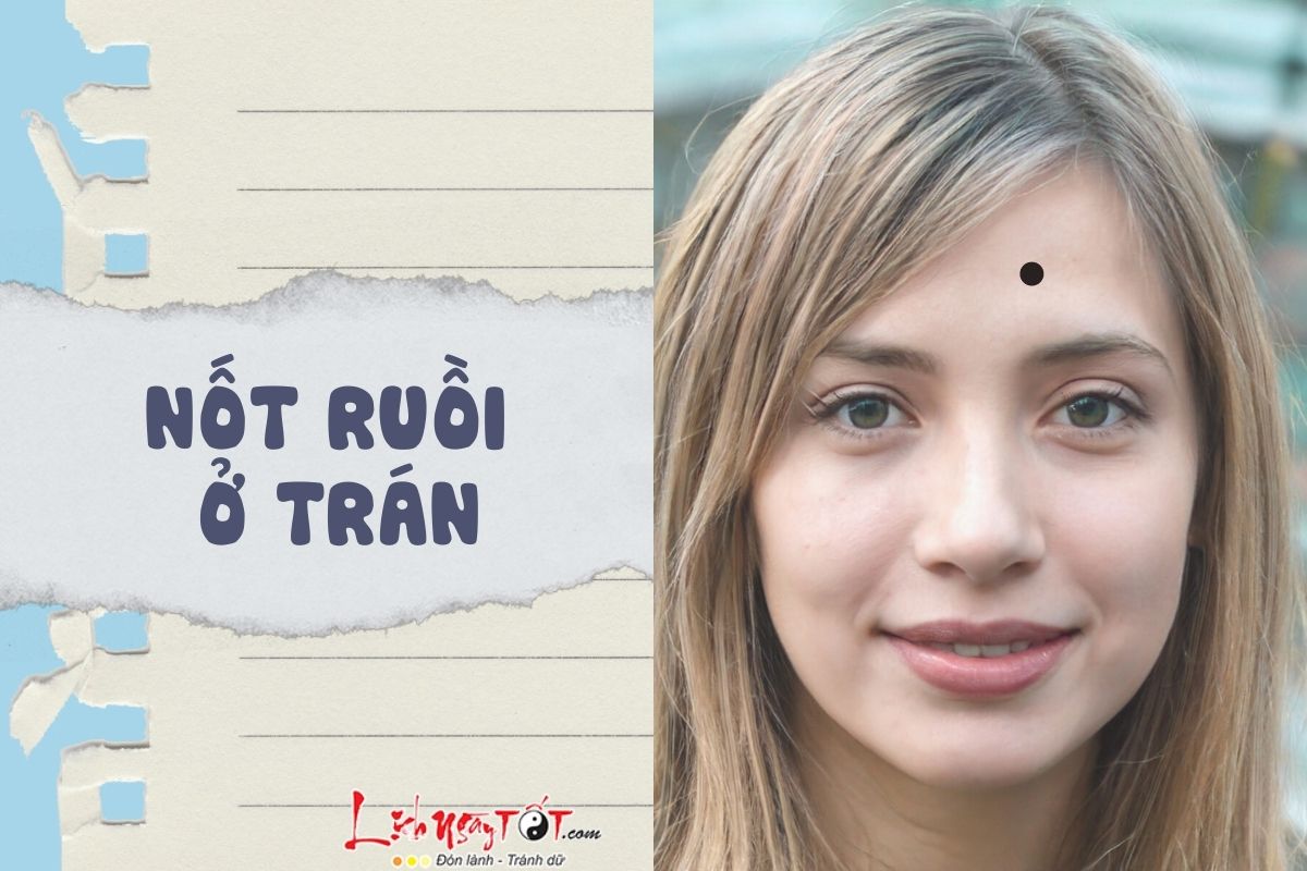 Nốt ruồi ở trán Not ruoi o tran