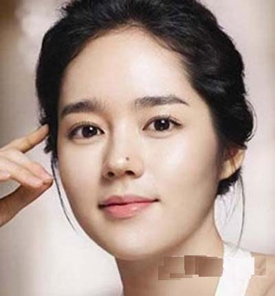 Nốt ruồi vượng phu trên gương mặt nữ giới hình ảnh 4 Not ruoi vuong phu tren guong mat nu gioi hinh anh 4